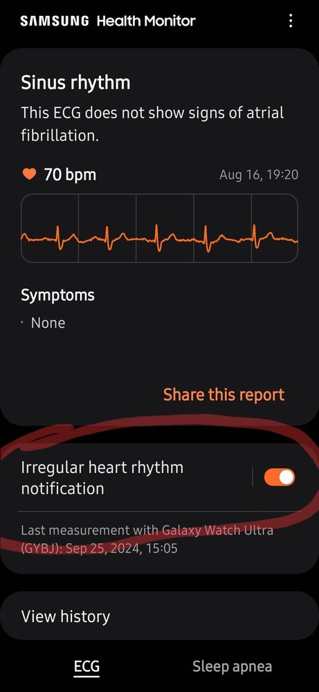 Screenshot_20240925_150731_Samsung Health Monitor.jpg
